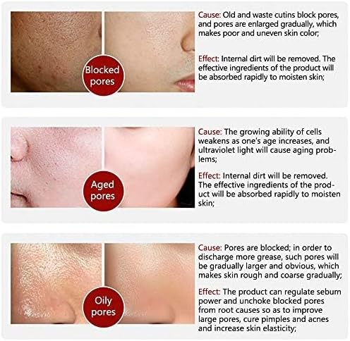 سيروم حل المسام